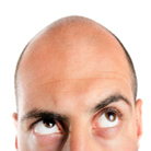 קרחות וטיפולים