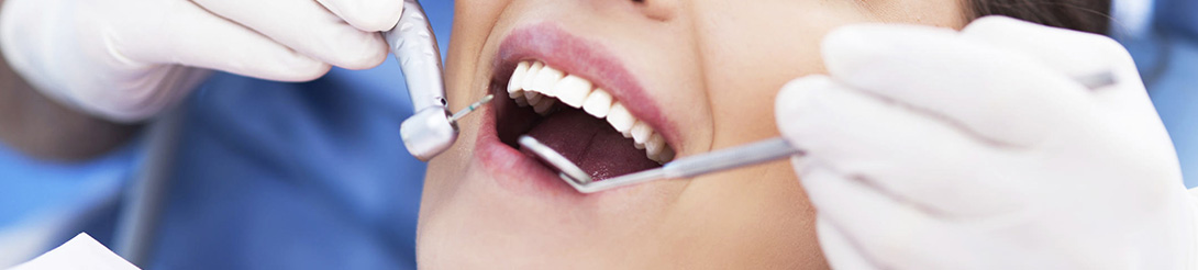 מחירון טיפולי שיניים 2023