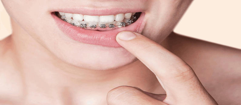 כתבות בנושא רופאי שיניים - תמונת אווירה