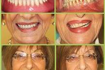 תמונה שצולמה להמחשת העבודות של ד"ר יואלי צבי - 2 תמונה של ד"ר יואלי צבי