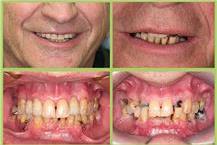 תמונה שצולמה להמחשת העבודות של ד"ר יואלי צבי - 1 תמונה של ד"ר יואלי צבי