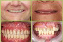 תמונה שצולמה להמחשת העבודות של ד"ר יואלי צבי - 3 תמונה של ד"ר יואלי צבי