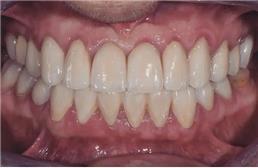 תמונה של אס.אר. דנטליין