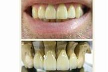 תמונה שצולמה להמחשת העבודות של אס.אר. דנטליין תמונה של אס.אר. דנטליין