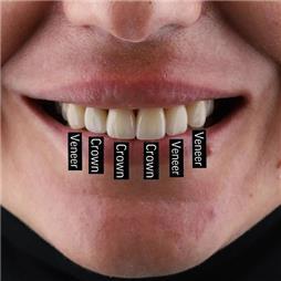 תמונה של אס.אר. דנטליין