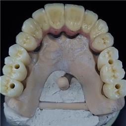 תמונה שצולמה להמחשת העבודות של אס.אר. דנטליין תמונה של אס.אר. דנטליין