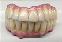 תמונה שצולמה להמחשת העבודות של אס.אר. דנטליין תמונה של אס.אר. דנטליין