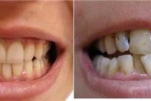 מעבדת שיניים בהרצליה