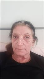 תמונה שצולמה להמחשת העבודות של אמונה מירי- קוסמטיקה מתקדמת תמונה של אמונה מירי- קוסמטיקה מתקדמת