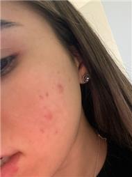 תמונה שצולמה להמחשת העבודות של אמונה מירי- קוסמטיקה מתקדמת תמונה של אמונה מירי- קוסמטיקה מתקדמת