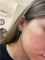 תמונה שצולמה להמחשת העבודות של אמונה מירי- קוסמטיקה מתקדמת תמונה של אמונה מירי- קוסמטיקה מתקדמת