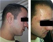 תמונה שצולמה להמחשת העבודות של מכון אחווה - חגית תמונה של מכון אחווה - חגית