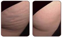 תמונה שצולמה להמחשת העבודות של מכון אחווה - חגית תמונה של מכון אחווה - חגית