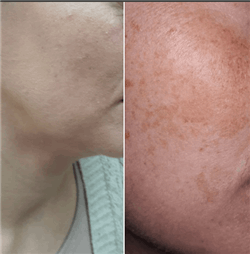 תמונה שצולמה להמחשת העבודות של מכון אחווה - חגית תמונה של מכון אחווה - חגית