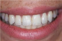 תמונה שצולמה להמחשת העבודות של ד"ר ילנה קוסטנצקי תמונה של ד"ר ילנה קוסטנצקי