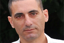 תמונה שצולמה להמחשת העבודות של ד"ר זיסו מאיר - 1 ד"ר זיסו מאיר - מומחה לטיפולי שורש בירושלים