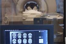 אבחון נוירולוגי