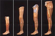 בניית  תותבות