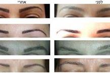 תמונה שצולמה להמחשת העבודות של טל קורן קוסמטיקה רפואית איפור קבוע וסידור גבות