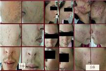 תמונה שצולמה להמחשת העבודות של אליעד לוי - מרכז קוסמטי - 1 תמונה של אליעד לוי - מרכז קוסמטי