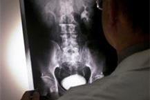 תמונה שצולמה להמחשת העבודות של ד"ר ולן גד ד"ר גד ולן