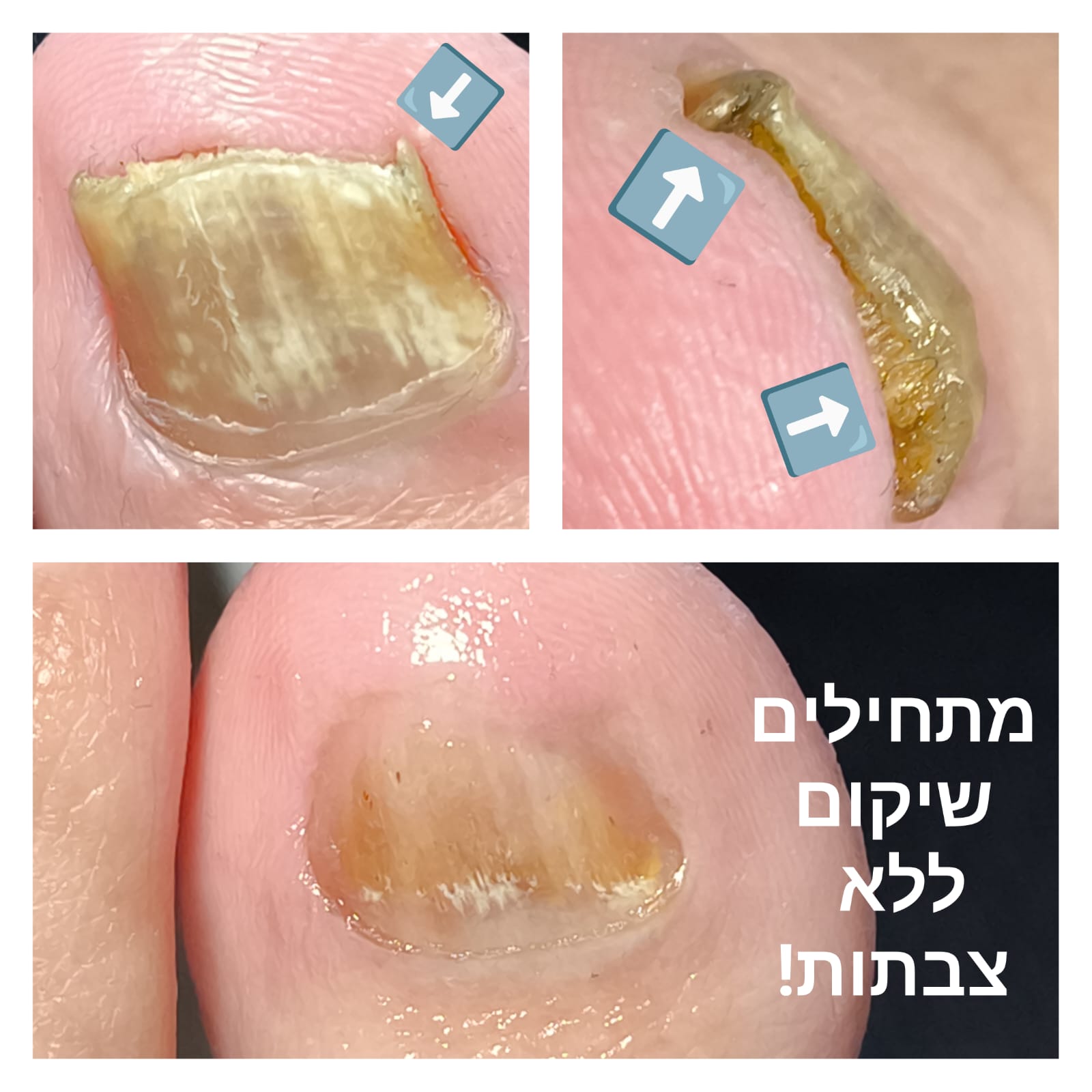 תמונה שצולמה להמחשת העבודות של נירה סלנט - פדיקור פארא-רפואי תמונה של נירה סלנט - פדיקור פארא-רפואי