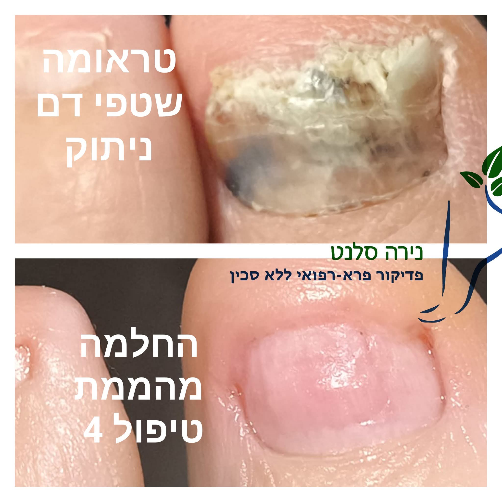 תמונה שצולמה להמחשת העבודות של נירה סלנט - פדיקור פארא-רפואי תמונה של נירה סלנט - פדיקור פארא-רפואי