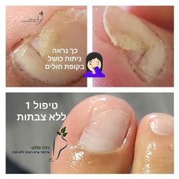 תמונה של נירה סלנט - פדיקור פארא-רפואי