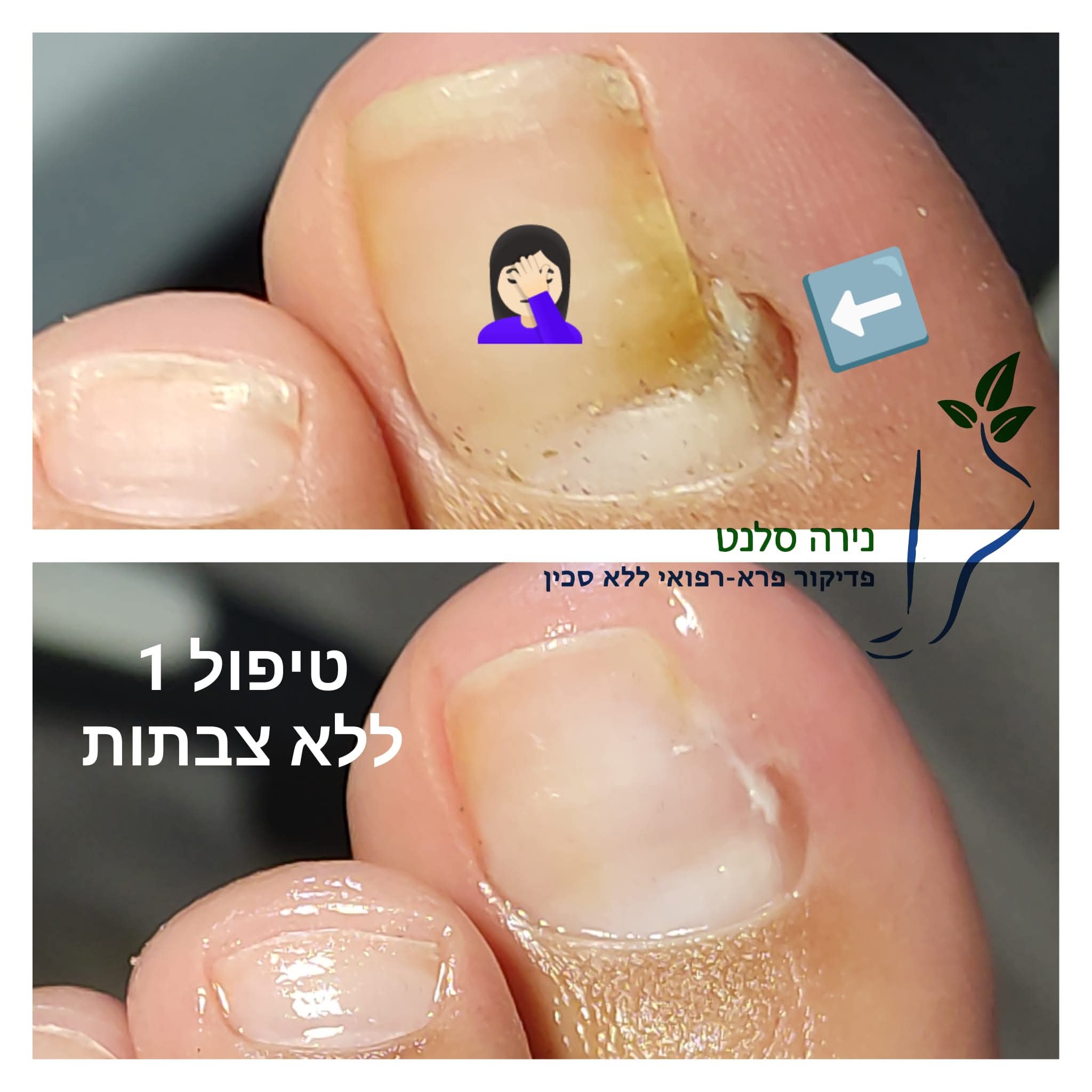 תמונה שצולמה להמחשת העבודות של נירה סלנט - פדיקור פארא-רפואי תמונה של נירה סלנט - פדיקור פארא-רפואי