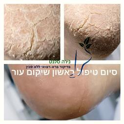 תמונה של נירה סלנט - פדיקור פארא-רפואי