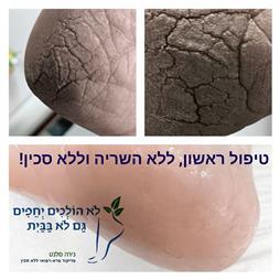 תמונה של נירה סלנט - פדיקור פארא-רפואי