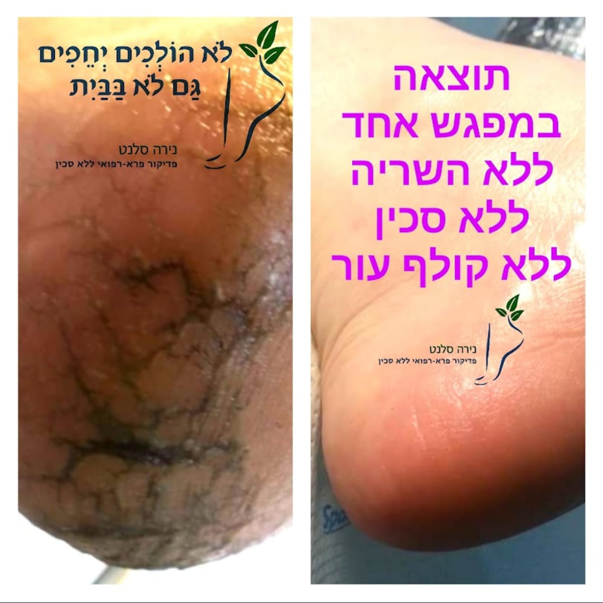 תמונה שצולמה להמחשת העבודות של נירה סלנט - פדיקור פארא-רפואי תמונה של נירה סלנט - פדיקור פארא-רפואי
