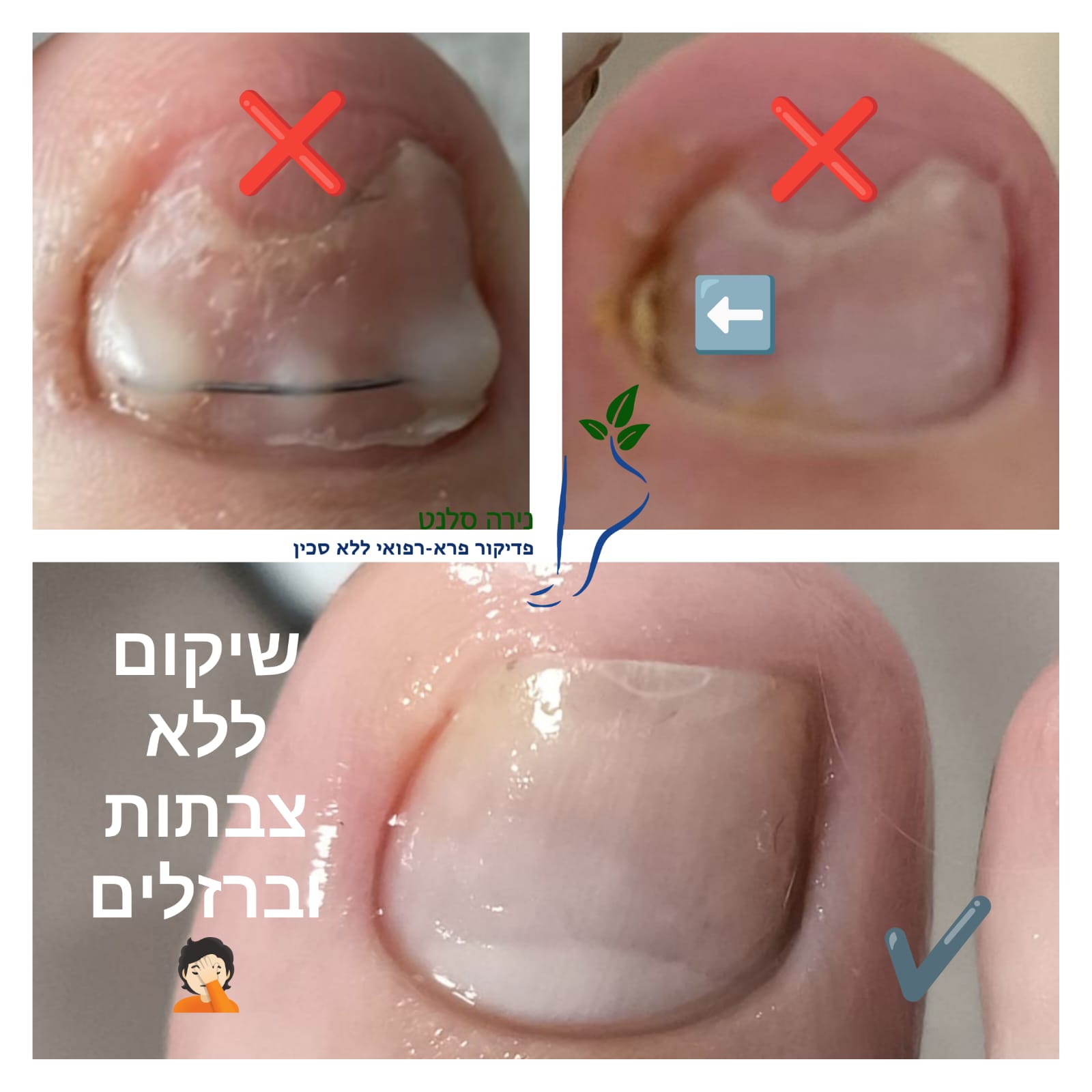תמונה שצולמה להמחשת העבודות של נירה סלנט - פדיקור פארא-רפואי תמונה של נירה סלנט - פדיקור פארא-רפואי