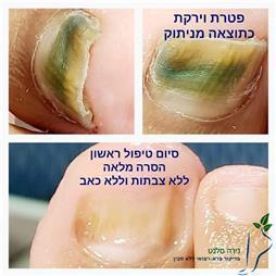 תמונה של נירה סלנט - פדיקור פארא-רפואי