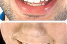 תמונה שצולמה להמחשת העבודות של ד"ר עבד חיראללה תמונה של ד"ר עבד חיראללה