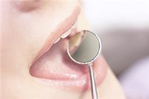 תמונה שצולמה להמחשת העבודות של סיטי דנט - מרפאת שיניים חולון - 2 תמונה של סיטי דנט - מרפאת שיניים חולון