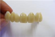 תמונה שצולמה להמחשת העבודות של אומני שן ייצור תותבות