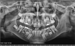 תמונה של פנורמי סנטר