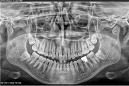 תמונה של פנורמי סנטר