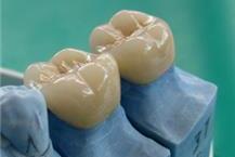 מעבדת שיניים בבאר שבע