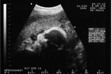 תמונה שצולמה להמחשת העבודות של פרופ' מיכל שמחן - 2 בדיקת העמסת סוכר