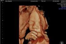 בדיקות אולטרה-סאונד