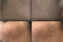 תמונה שצולמה להמחשת העבודות של סטלה סטייל בניית ציפורניים