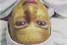 תמונה שצולמה להמחשת העבודות של סטלה סטייל טיפול באקנה