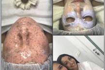 תמונה שצולמה להמחשת העבודות של סטלה סטייל קוסמטיקאיות