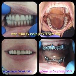 תמונה שצולמה להמחשת העבודות של בארי ישראלי תמונה של בארי ישראלי