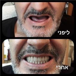 תמונה שצולמה להמחשת העבודות של בארי ישראלי תמונה של בארי ישראלי