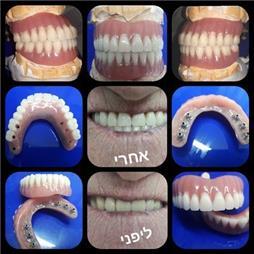 תמונה שצולמה להמחשת העבודות של בארי ישראלי תמונה של בארי ישראלי