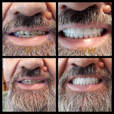 תמונה שצולמה להמחשת העבודות של בארי ישראלי תמונה של בארי ישראלי