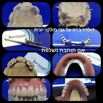 תמונה שצולמה להמחשת העבודות של בארי ישראלי תמונה של בארי ישראלי